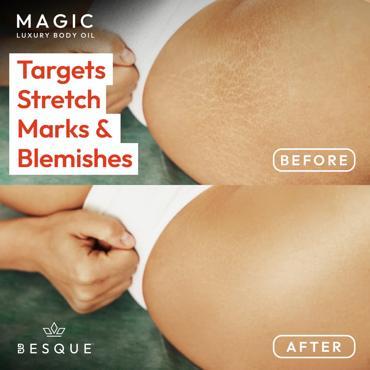 Besque® Magic Body Oil - 100 ml